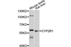 Western blot analysis of extracts of various cell lines, using CYP2R1 antibody (ABIN4903430) at 1:1000 dilution. (CYP2R1 抗体)