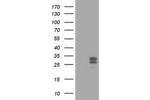 Image no. 4 for anti-O6-Methylguanine-DNA-Methyltransferase (MGMT) antibody (ABIN1499456) (MGMT 抗体)