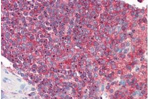 Human Spleen: Formalin-Fixed, Paraffin-Embedded (FFPE) (ICAM-3/CD50 抗体)
