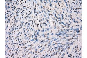 Immunohistochemical staining of paraffin-embedded Ovary tissue using anti-MAP2K1 mouse monoclonal antibody. (MEK1 抗体)