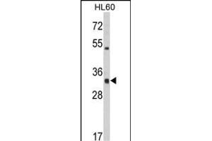 Western blot analysis of HLA-DRA Antibody (C-term) (ABIN390771 and ABIN2841029) in HL60 cell line lysates (35 μg/lane). (HLA-DRA 抗体  (C-Term))