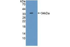 Detection of Recombinant RPS6Ka1, Human using Polyclonal Antibody to Ribosomal Protein S6 Kinase Alpha 1 (RPS6Ka1) (RPS6KA1 抗体  (AA 62-321))