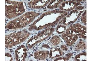 Immunohistochemical staining of paraffin-embedded Human Kidney tissue using anti-C1S mouse monoclonal antibody.