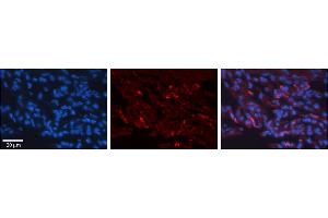 Rabbit Anti-H6PD Antibody     Formalin Fixed Paraffin Embedded Tissue: Human Lung Tissue  Observed Staining: Cytoplasmic in alveolar type I cells  Primary Antibody Concentration: 1:100  Other Working Concentrations: 1/600  Secondary Antibody: Donkey anti-Rabbit-Cy3  Secondary Antibody Concentration: 1:200  Magnification: 20X  Exposure Time: 0. (Glucose-6-Phosphate Dehydrogenase 抗体  (N-Term))