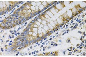 Immunohistochemistry of paraffin-embedded Human colon using KRT20 Polyclonal Antibody at dilution of 1:100 (40x lens). (KRT20 抗体)