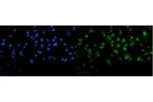 IF analysis of METTL3 using anti-METTL3 antibody (ABIN7602808). (METTL3 抗体  (C-Term))
