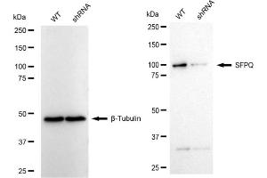 Western blotting analysis using SFPQ antibody (ABIN7800427).