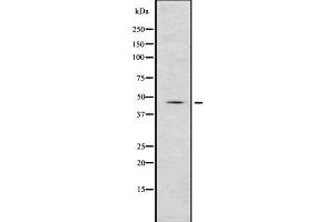 Western blot analysis of Renin using COLO205 whole  lysates. (Renin 抗体  (Internal Region))