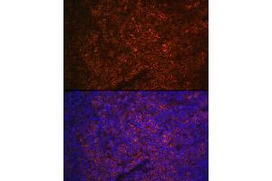 Immunofluorescence analysis of mouse spleen using P2RX5 Rabbit pAb (ABIN6132450, ABIN6145117, ABIN6145118 and ABIN6215403) at dilution of 1:100 (40x lens). (P2RX5 抗体  (AA 341-422))