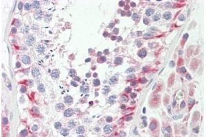 Human Testis: Formalin-Fixed, Paraffin-Embedded (FFPE) (UQCRC2 抗体  (AA 235-264))