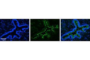 Rabbit Anti-MRPS15 Antibody  Catalog Number: ARP33299_P050  Formalin Fixed Paraffin Embedded Tissue: Human Bronchial Epithelial Tissue  Observed Staining: Plasma Membrane  Primary Antibody Concentration: 1:100  Secondary Antibody: Donkey anti-Rabbit-Cy3  Secondary Antibody Concentration: 1:200  Magnification: 20X  Exposure Time: 0. (MRPS15 抗体  (N-Term))
