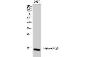 Western Blotting (WB) image for anti-Histone H2B (Tyr740) antibody (ABIN6280070)