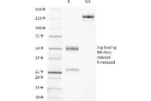SDS-PAGE Analysis Purified CD21-Monospecific Mouse Monoclonal Antibody (CR2/3247). (CD21 抗体  (AA 142-240))