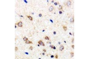 Immunohistochemical analysis of 42431 staining in human brain formalin fixed paraffin embedded tissue section. (MARCH2 抗体  (C-Term))