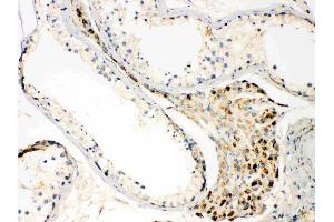TECTA was detected in paraffin-embedded sections of human testis tissues using rabbit anti- TECTA Antigen Affinity purified polyclonal antibody (Catalog # ) at 1 µg/mL. (TECTA 抗体  (N-Term))