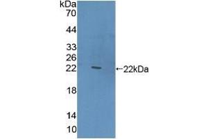 Western blot analysis of recombinant Human CLEC10A. (CLEC10A 抗体  (AA 71-239))