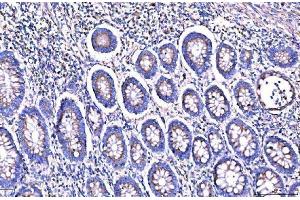 IHC analysis of Giantin/GOLGB1 using anti-Giantin/GOLGB1 antibody (ABIN7600139).