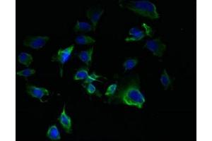 Immunofluorescent analysis of U251 cells using ABIN7172942 at dilution of 1:100 and Alexa Fluor 488-congugated AffiniPure Goat Anti-Rabbit IgG(H+L) (TM7SF3 抗体  (AA 22-295))