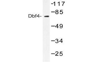 Western blot (WB) analysis of Dbf4 antibody in extracts from NIH-3T3 treated with H2O2 100uM 30'. (DBF4 抗体)