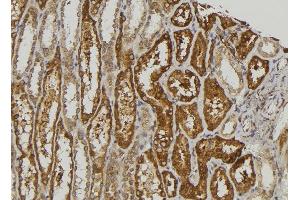 ABIN6274507 at 1/100 staining Human kidney tissue by IHC-P. (SLK 抗体  (C-Term))