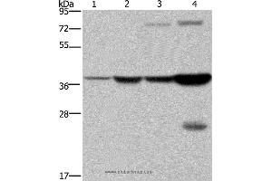 Western blot analysis of Mouse stomach and human fetal liver tissue, MCF-7 cell and mouse liver tissue, using FBP1 Polyclonal Antibody at dilution of 1:550 (FBP1 抗体)
