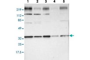 Western blot analysis of lane 1: RT-4, lane 2: U-251 MG, lane 3: A-431, lane 4: Liver and lane 5: Tonsil using STX4 polyclonal antibody . (Syntaxin 4 抗体)