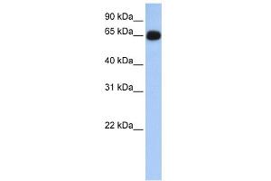 WB Suggested Anti-ALAS1 Antibody Titration: 0. (ALAS1 抗体  (N-Term))
