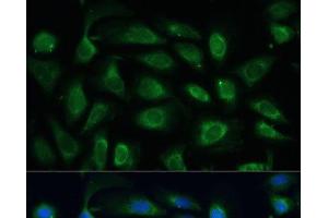 Immunofluorescence analysis of U-2 OS cells using SPARC Polyclonal Antibody at dilution of 1:100 (40x lens). (SPARC 抗体)