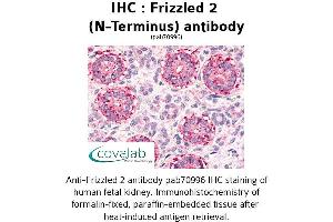 Image no. 1 for anti-Frizzled Family Receptor 2 (FZD2) (Extracellular Domain), (N-Term) antibody (ABIN1734468)