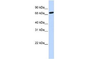 HAL antibody used at 1 ug/ml to detect target protein. (HAL 抗体  (N-Term))