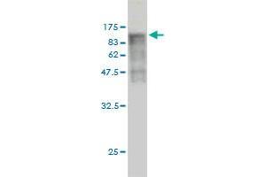 Western Blotting (WB) image for anti-Dynamin 1-Like (DNM1L) (AA 1-710) antibody (ABIN564347)