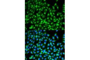Immunofluorescence (IF) image for anti-Cell Division Cycle 34 (CDC34) antibody (ABIN1876645) (CDC34 抗体)