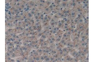 Detection of DDR1 in Human Liver Tissue using Polyclonal Antibody to Discoidin Domain Receptor Family, Member 1 (DDR1) (DDR1 抗体  (AA 568-829))