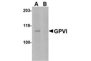 Image no. 1 for anti-Glycoprotein VI (Platelet) (GP6) (Internal Region) antibody (ABIN342706) (GP6 抗体  (Internal Region))