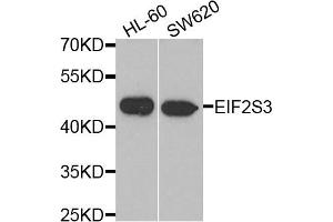 Western blot analysis of extracts of HL60 and SW620 cell lines, using EIF2S3 antibody. (EIF2S3 抗体)