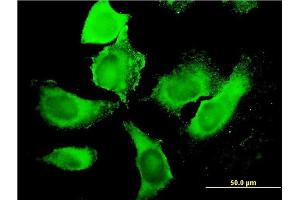 Immunofluorescence of monoclonal antibody to PIP5K3 on HeLa cell. (PIKFYVE 抗体  (AA 342-451))