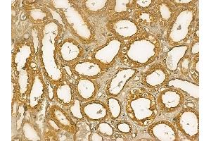 GMPPB Mouse Monoclonal Antibody at 1/100 staining human normal kidney tissue by IHC-P. (GMPPB 抗体)