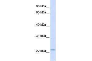 WB Suggested Anti-REEP1 Antibody Titration:  0. (Receptor Accessory Protein 1 抗体  (C-Term))