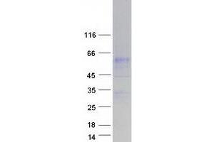 Validation with Western Blot (SLC34A3 Protein (Myc-DYKDDDDK Tag))