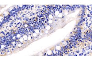 Detection of CYCS in Human Small intestine Tissue using Monoclonal Antibody to Cytochrome C (CYCS)