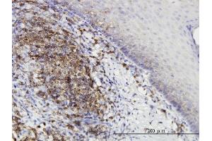Immunoperoxidase of monoclonal antibody to PRKD2 on formalin-fixed paraffin-embedded human tonsil. (PKD2 抗体  (AA 1-110))
