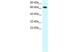 Western Blotting (WB) image for anti-Protein Inhibitor of Activated STAT, 3 (PIAS3) antibody (ABIN2460563)