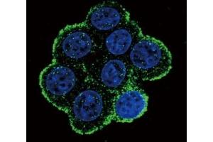 Confocal immunofluorescent analysis of BMPR1A antibody with 293 cells followed by Alexa Fluor 488-conjugated goat anti-rabbit lgG (green).