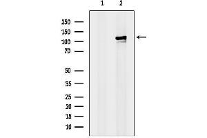 Western blot analysis of lysates from Rat brain, using MCM6 Antibody.