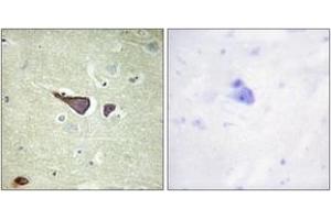 Immunohistochemistry analysis of paraffin-embedded human brain tissue, using IGF2R (Ab-2409) Antibody. (IGF2R 抗体  (AA 2381-2430))