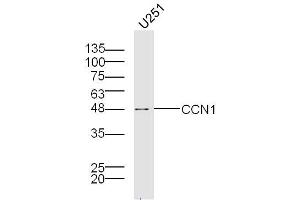 U251 lysates probed with Cry61 Polyclonal Antibody, Unconjugated  at 1:300 overnight at 4˚C. (CYR61 抗体  (AA 251-379))