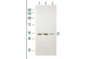 Western blot using Rockland's Affinity Purified anti-GSK3A antibody shows detection of a 52 kDa band corresponding to human GSK3A in various human derived 293T cell extracts. (GSK3 alpha 抗体  (pSer21))