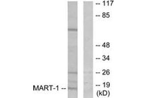 Western blot analysis of extracts from NIH-3T3 cells, using MART-1 Antibody. (MLANA 抗体  (AA 41-90))