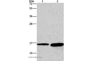 Western blot analysis of Mouse heart and human hepatocellular carcinoma tissue, using HINT2 Polyclonal Antibody at dilution of 1:300 (HINT2 抗体)