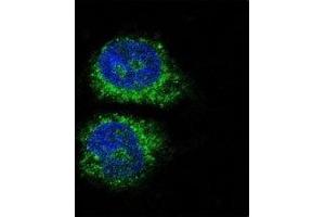 Confocal immunofluorescent analysis of NURR1 antibody with HeLa cells followed by Alexa Fluor 488-conjugated goat anti-rabbit lgG (green).
